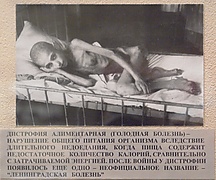 Дистрофияӧн шогалісь блокадник